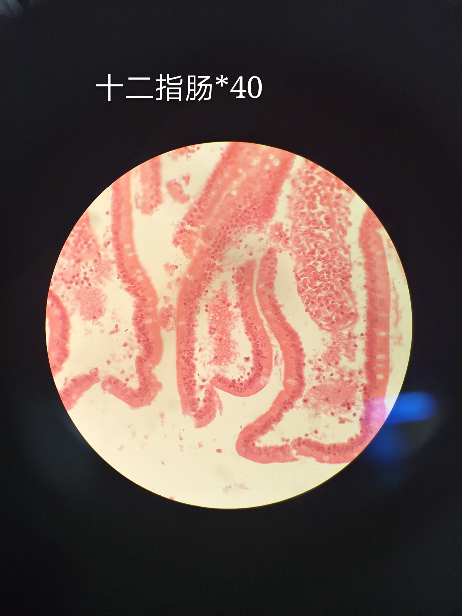  p>小肠腺(small intestinal gland) 位居 a targe
