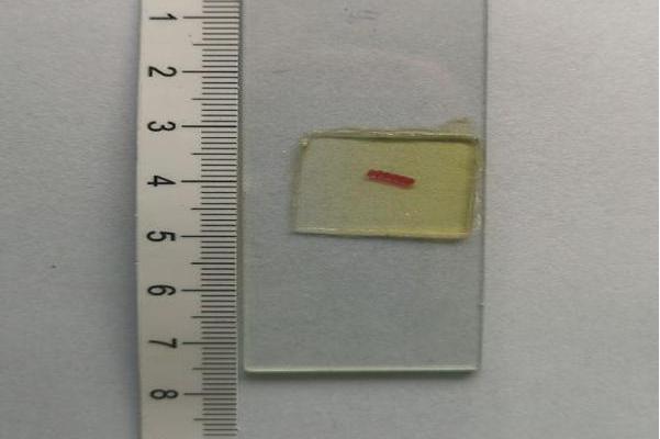 盖氏曲子宫绦虫