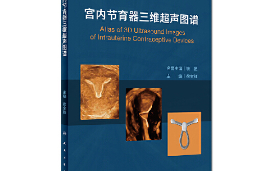 宫内节育器三维超声图谱