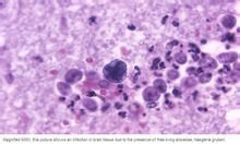 食脑阿米巴原虫