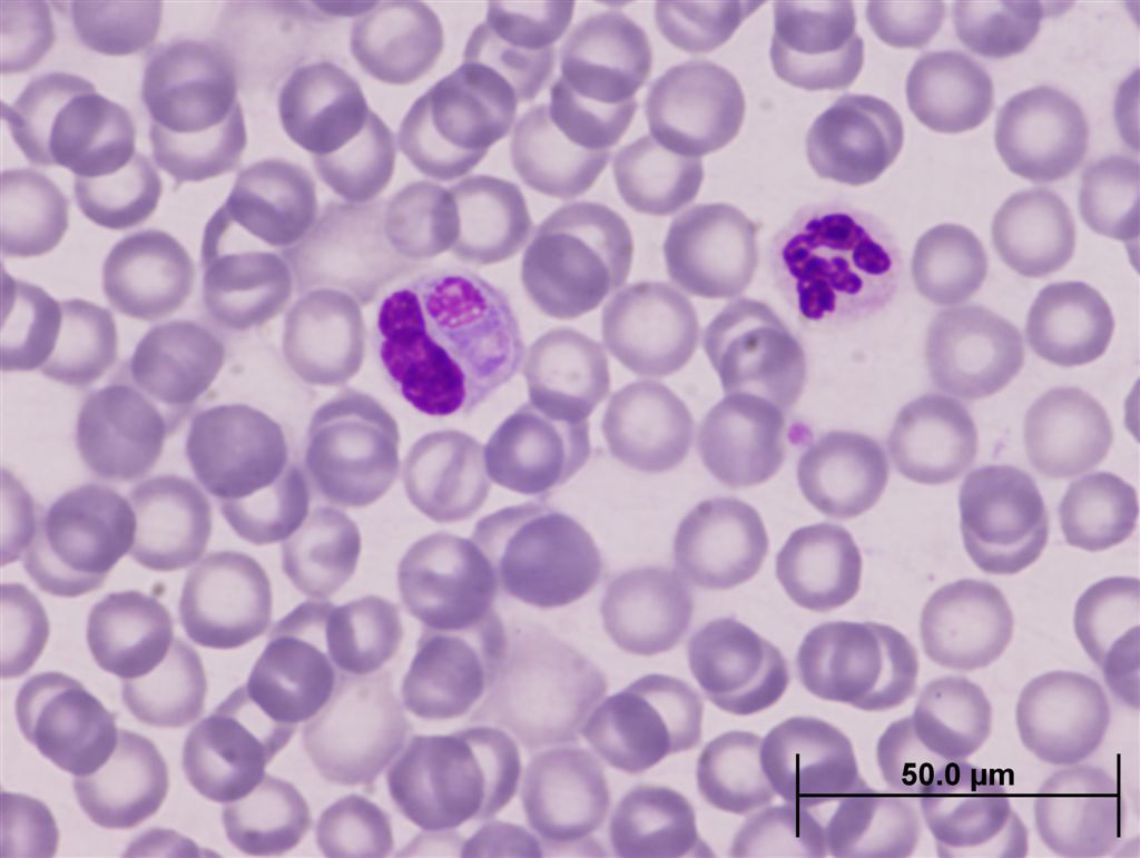  p>犬瘟--亦称犬瘟热,属于病原性病毒.主要侵犯狗科,鼬科动物.