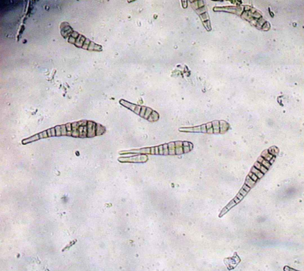  p>人参黑斑病是由人参链格孢等引起的,发生在 a href="#" data-lemma