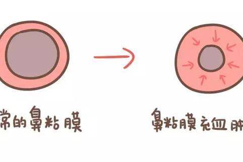 鼻粘膜