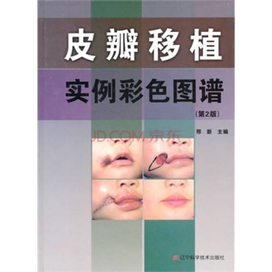 皮瓣移植实例彩色图谱（2011年辽宁科学技术出版社出版的图书）_百度百科