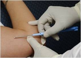  p>皮下埋植避孕法是一种新型的避孕方法,通过在使用者大臂内侧埋植