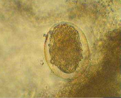 血吸虫卵
