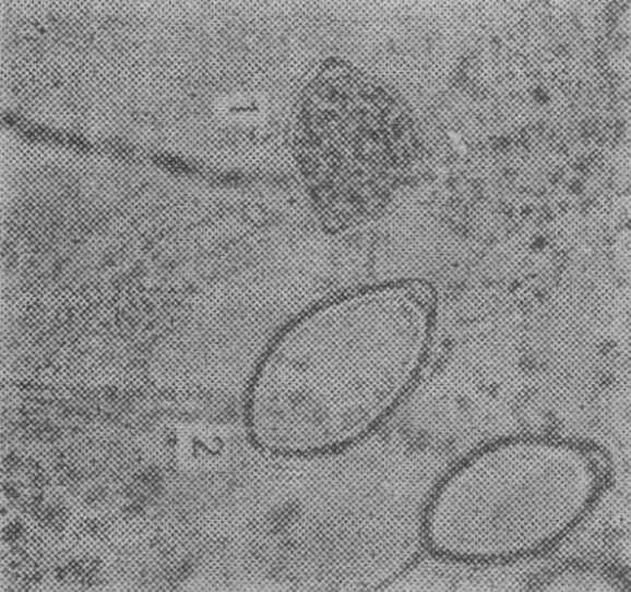  p>茄子疫病是由辣椒疫霉菌引起的,发生在 a target="_blank" href="