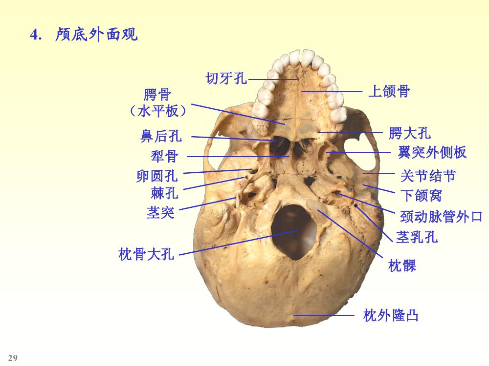 由脑颅骨与面颅骨组成.