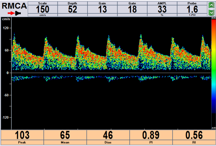 是利用人类颅骨自然薄弱的部位作为检测声