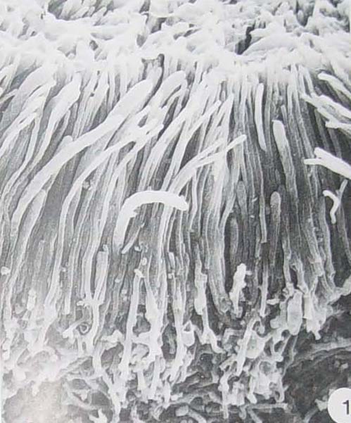  p>核盘菌属,菌核由黑色的外层和白色的髓部组成