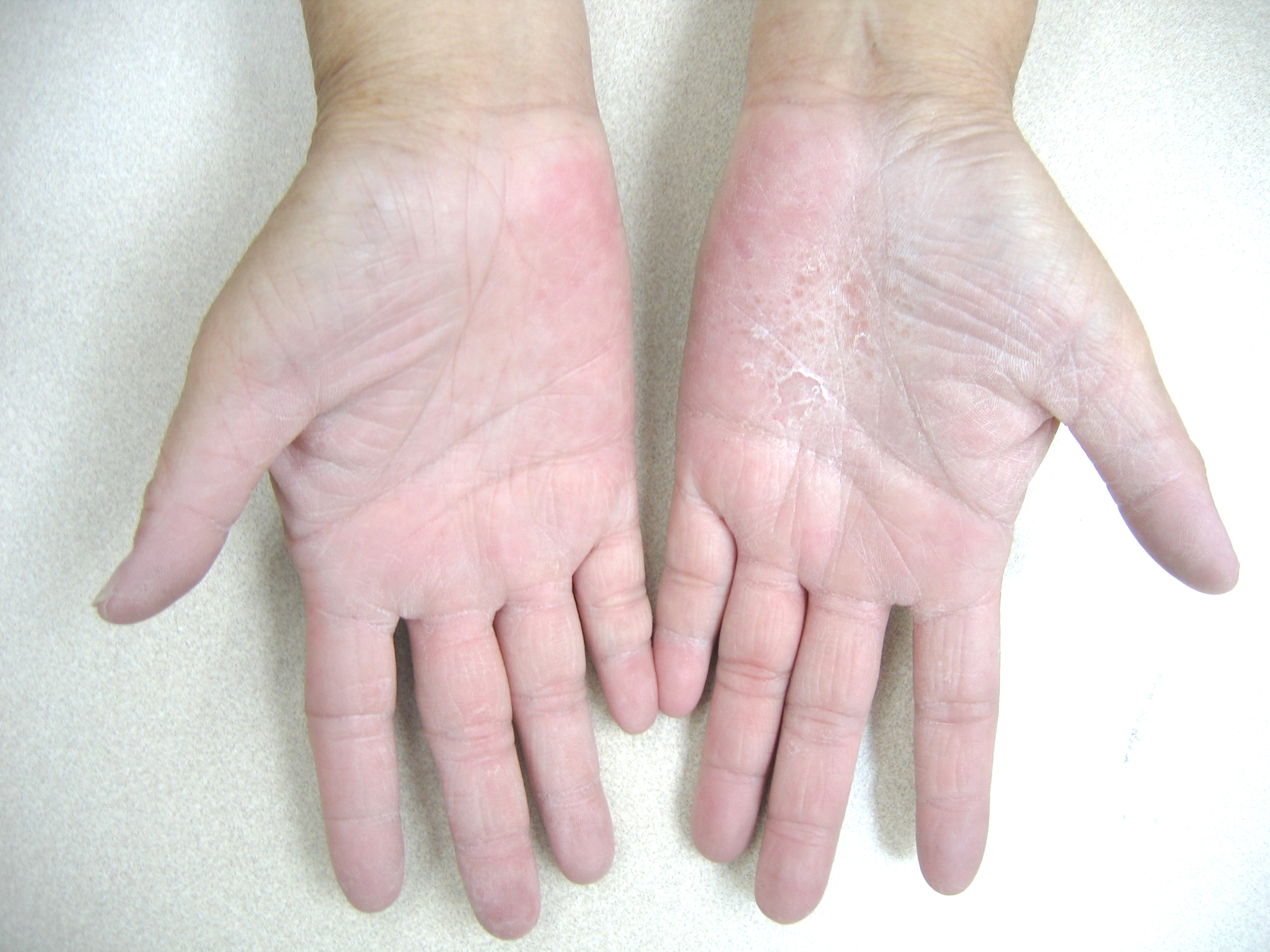  p data-id="gncntiwwyg">寄生虫与皮肤病有着密切关系.