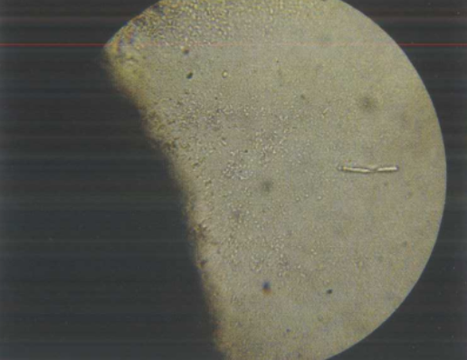  p>番茄疮痂病是由野油菜黄单胞菌疮痂致病变种引起的,发生在 a