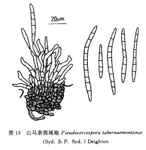 trichia heteroelaterum h.z.li et y.li sp. nov.