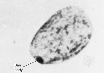  p>巴氏小体指在哺乳动物 a target="_blank" href="/item/体细胞核">