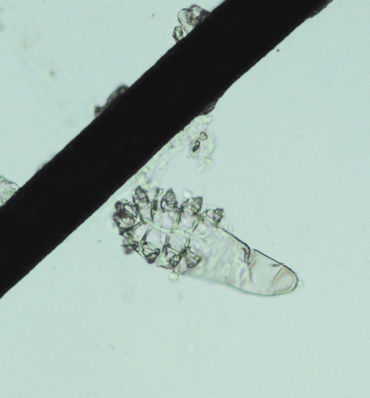 螨虫属于<a href="#" data