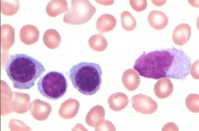  p>单核细胞(monocytes)是血液中最大的 a href="#" data-lemmaid="