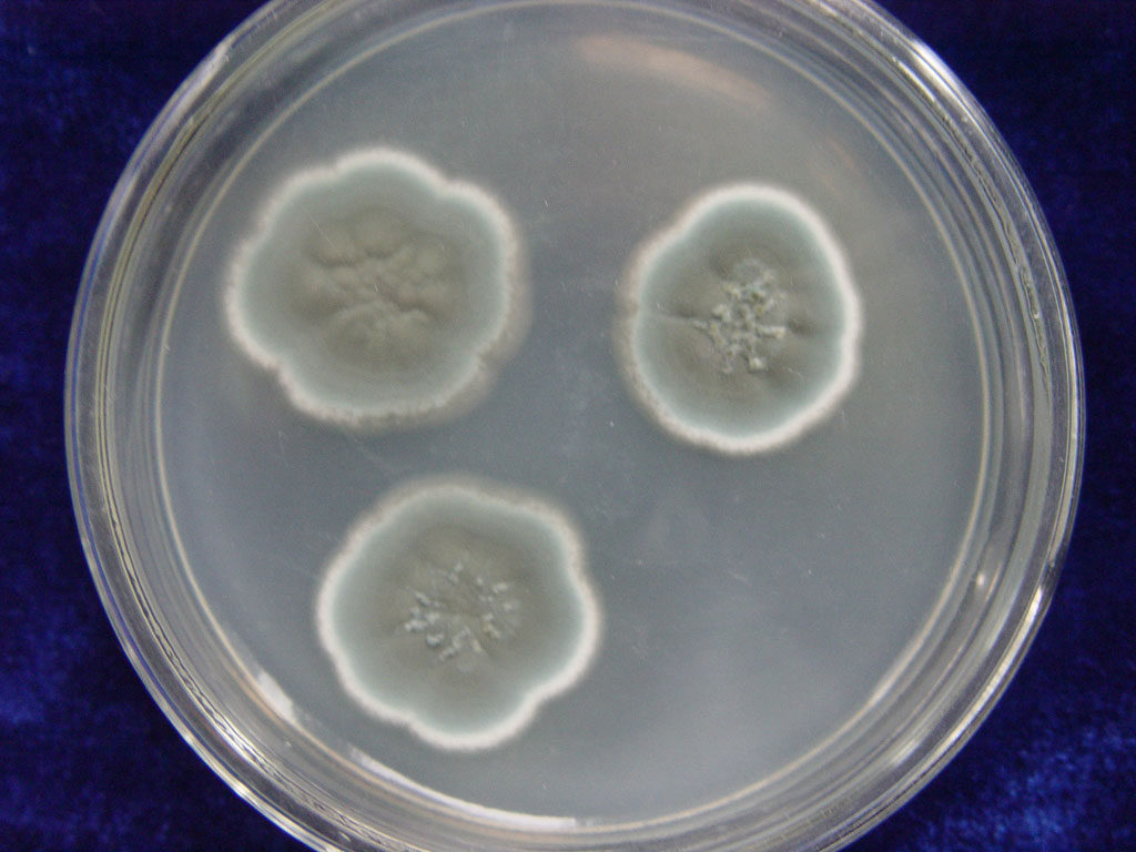  p>匍枝根霉(拉丁名:rhizopus stolonifer)亦称黑面包霉,是一种常见的
