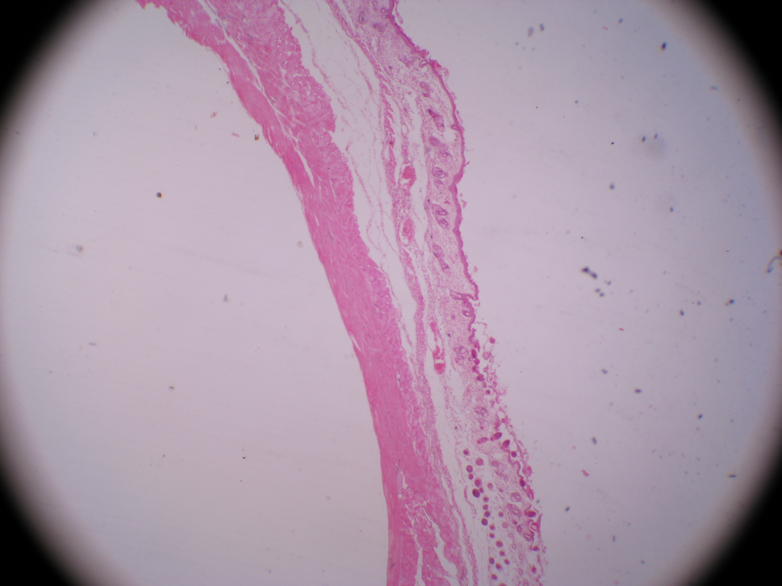  p data-id="gnws4vny5u">尾蚴, a target="_blank" href="/item/吸虫