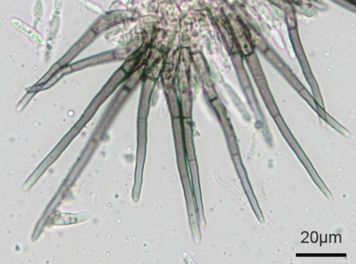 data-id="gnf825mho6">马铃薯炭疽病是由球炭疽菌(刺盘孢)引起的,发生