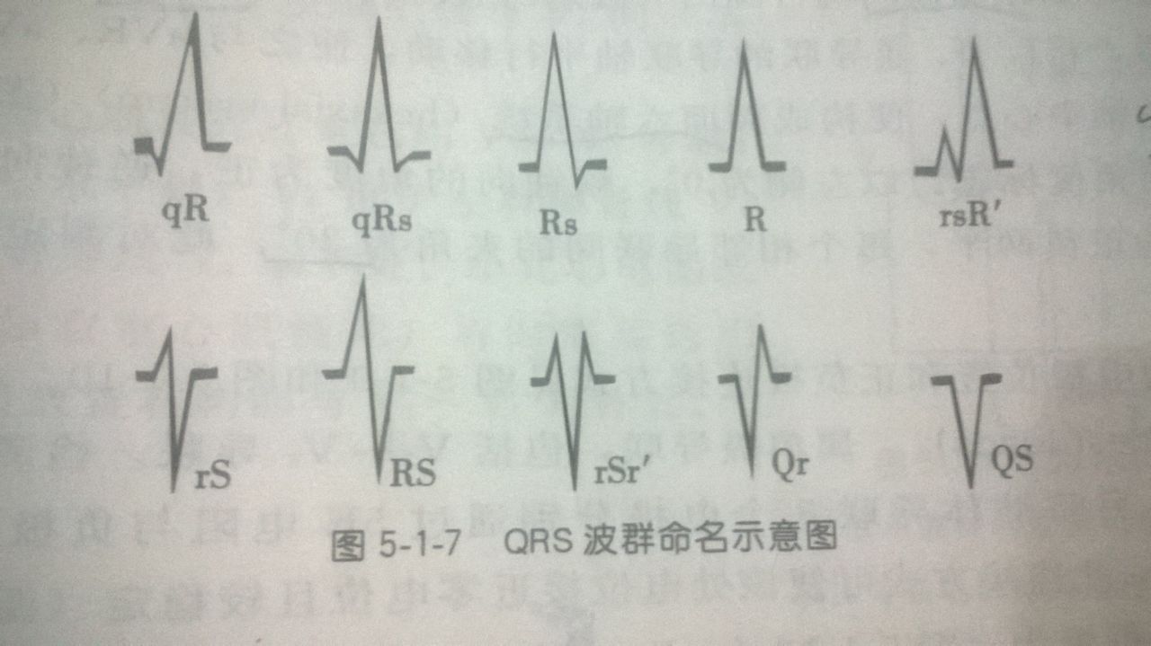 qrs电轴 全网资源