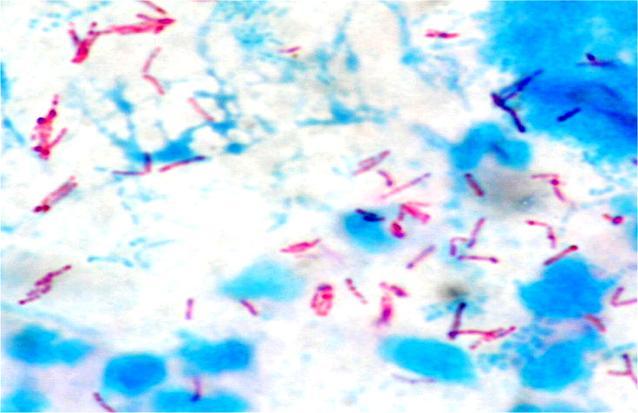 mycobacterium leprae