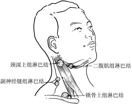  p>癌性恶病质(cancer cachexia,cc)主要是由肿瘤 a target="_blank"