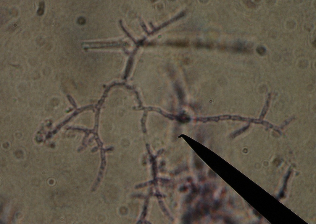  p>放线菌类(actinomycetes,ray fungi)具有分枝的丝状 a href="#"