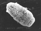  p data-id="gnay0f74do">多房棘球绦虫形态和生活史均与细粒棘球绦虫