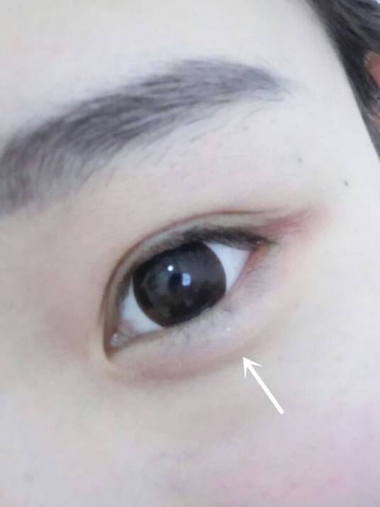 眼苔_百度百科