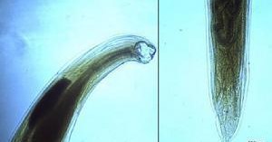  p>十二指肠钩口线虫(ancylostoma duodenale),简称为十二指肠钩虫,寄