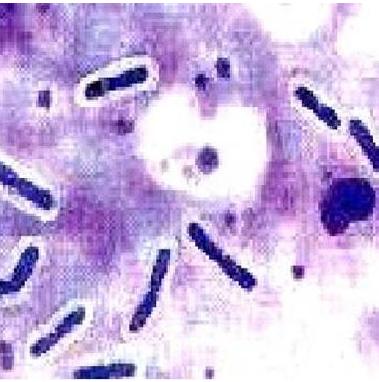  p>产气荚膜梭菌(clostridium perfringens)为厌氧革兰氏阴性粗大芽孢