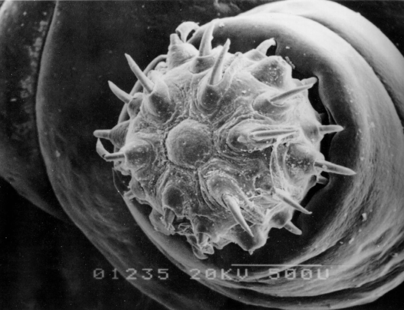 人体,引起 a target="_blank" href="/item/猪巨吻棘头虫病/1224280"