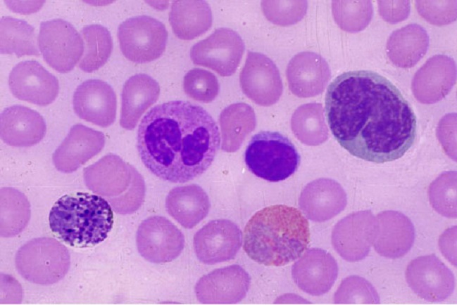  p>淋巴细胞(lymphocyte)是白细胞的一种,是体积最小的白细胞.