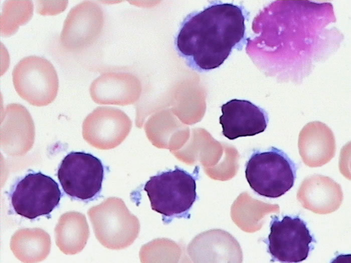  p data-id="go1a345pnn">巨核细胞(megakaryocyte)是骨髓中的一种从 