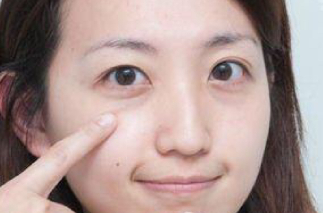 id="go0o0dcyqo">泪沟是指由内眼角开始出现在下眼睑靠鼻侧的一条凹沟