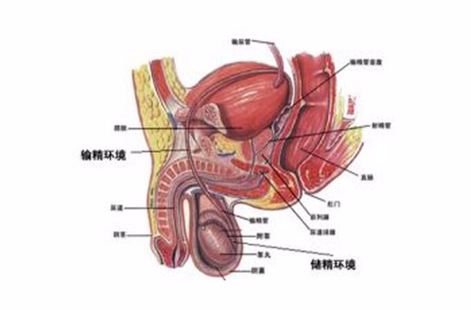 左侧精索静脉曲张