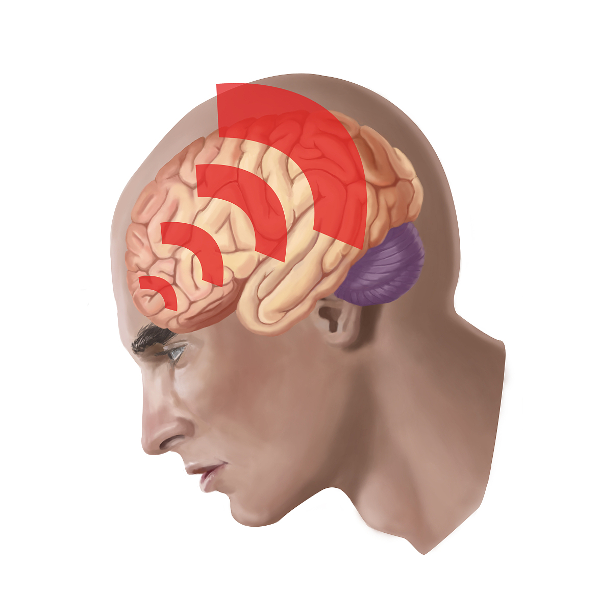  p data-id="gnwp4vzr9z">脑震荡是指头部遭受外力打击后,即刻发生