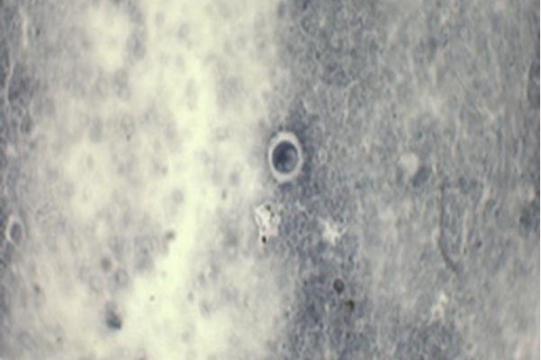 布氏嗜碘阿米巴包囊