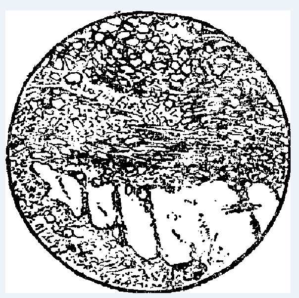 超糜棱岩是岩石发生糜棱岩化的高级阶段的产物,具糜棱结构,碎斑