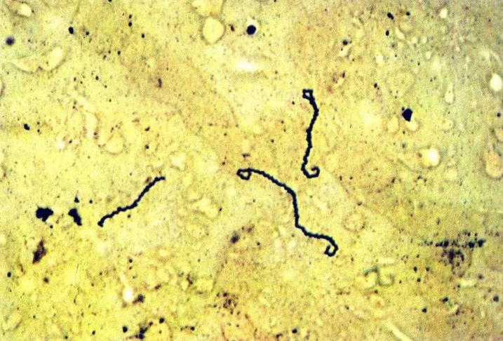  p>钩端螺旋体(leptospira)简称钩体,种类很多,可分为致病性钩体及非