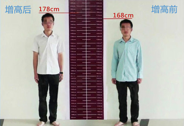 增高