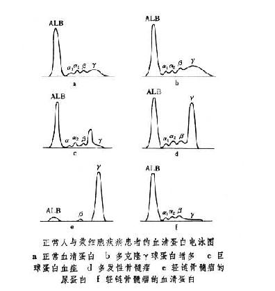 血清蛋白