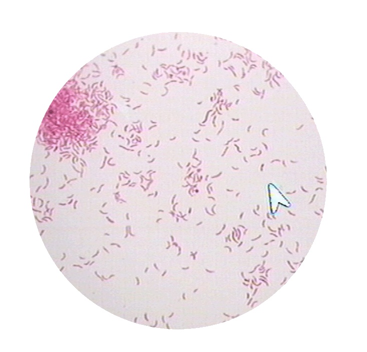 阴性菌泛指 a target="_blank" href="/item/革兰氏染色反应/3211029"