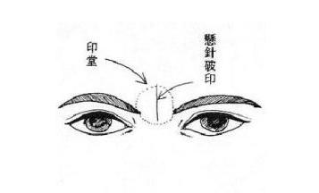 长出烦恼线来,就是两眉中间靠两边的纹路;再愁眉苦脸,他就长出"悬针纹