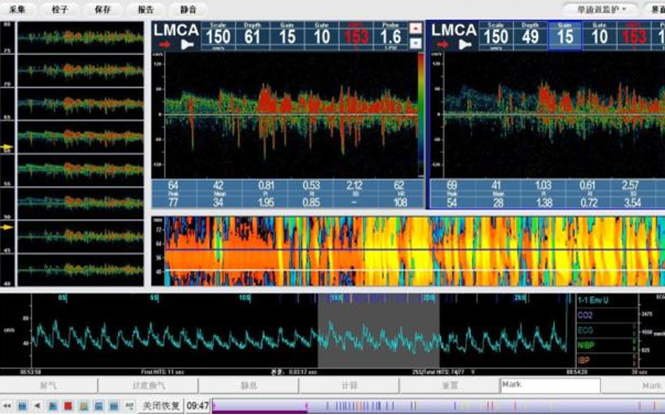 是利用人类颅骨自然薄弱的部位作为检测声