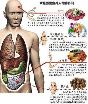 人体寄生虫