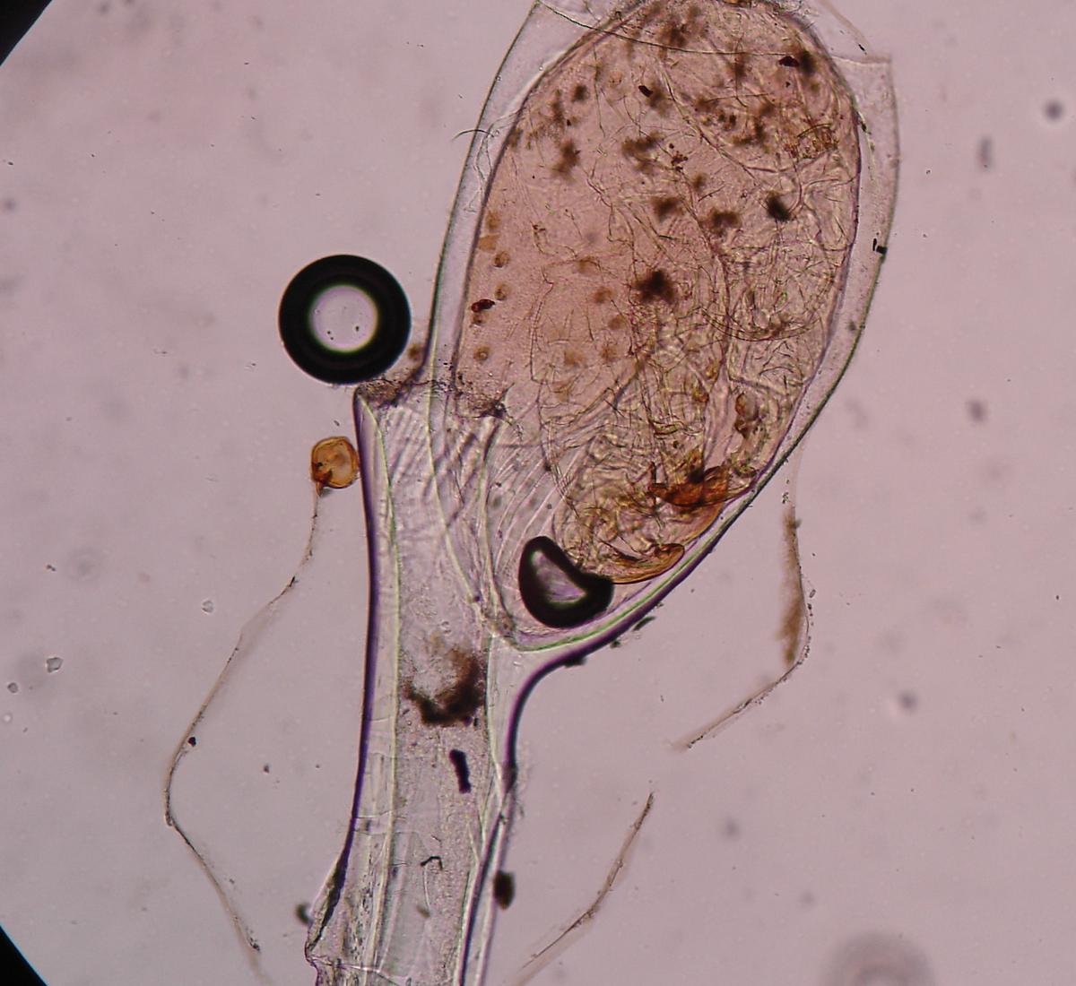  p>虮子,即虱卵,虱的卵,呈白色,为白色芝蔴三分之一大.