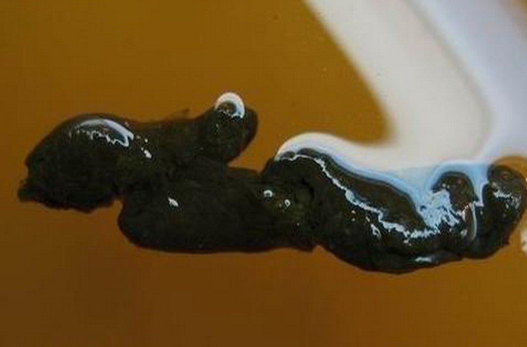  p>便溏是指大便不成形,形似溏泥,俗称薄粪. /p>