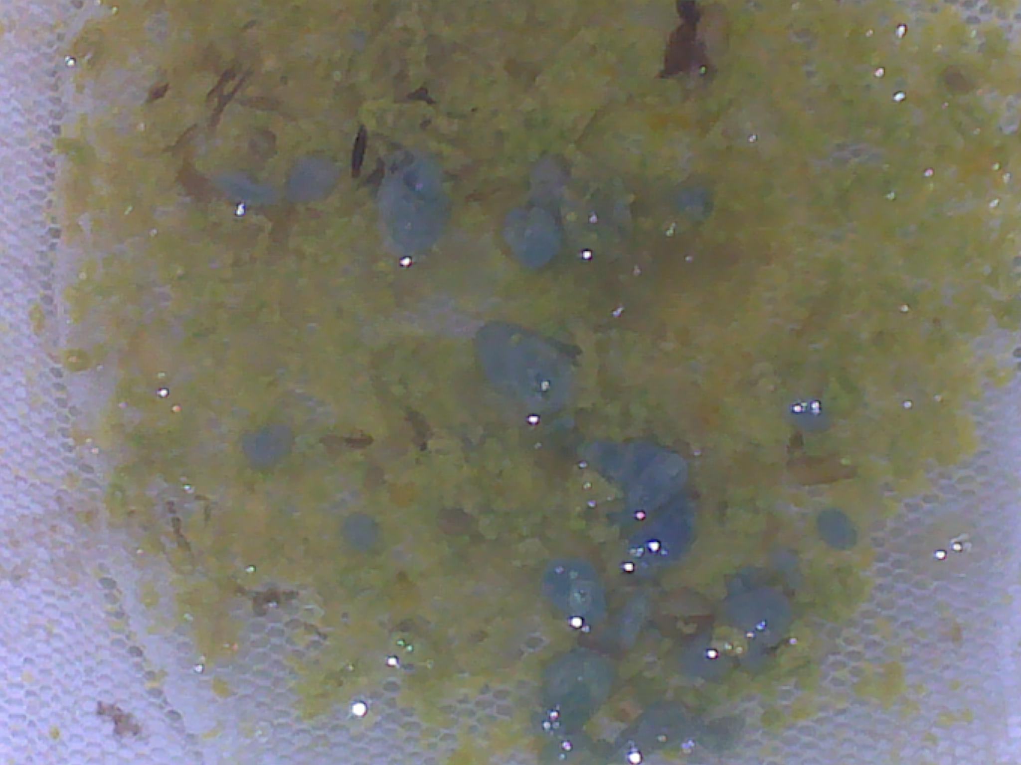  p>粘液便,正常粪便中的少量粘液,困与粪便均匀混合不易察觉,若有肉眼