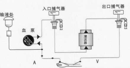 血液灌流器_百度百科